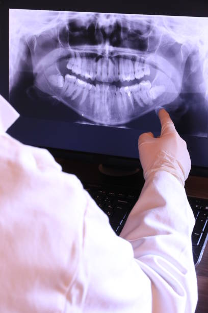 Best Emergency Dental Care for Abscessed Tooth in Heber, CA