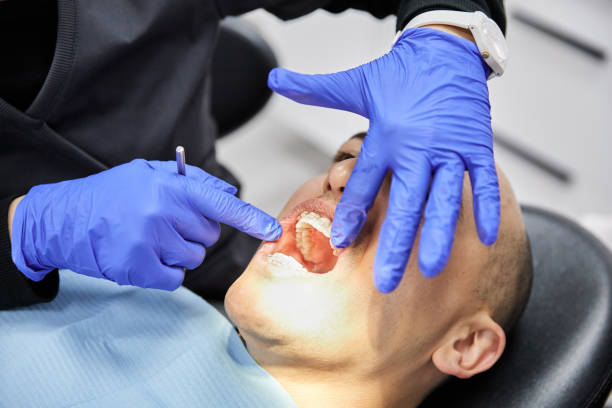 Best Mobile Emergency Dentist in Heber, CA